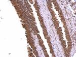 alpha Adducin Antibody in Immunohistochemistry (Paraffin) (IHC (P))