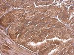 alpha Adducin Antibody in Immunohistochemistry (Paraffin) (IHC (P))