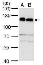 alpha Adducin Antibody in Western Blot (WB)