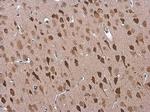 ADORA2B Polyclonal Antibody