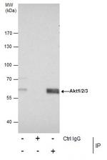 AKT Pan Antibody in Immunoprecipitation (IP)