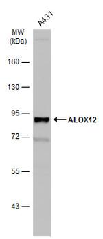 ALOX12 Polyclonal Antibody