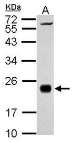 RhoA Antibody in Western Blot (WB)