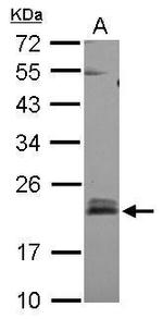 RhoB Antibody in Western Blot (WB)