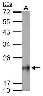 RhoB Antibody in Western Blot (WB)