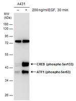 Phospho-ATF1 (Ser63) Polyclonal Antibody