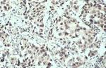 Phospho-ATM (Ser1981) Antibody in Immunohistochemistry (Paraffin) (IHC (P))