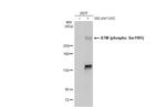 Phospho-ATM (Ser1981) Antibody in Western Blot (WB)