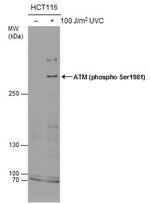 Phospho-ATM (Ser1981) Antibody in Western Blot (WB)