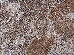 Phospho-ATM (Ser1981) Antibody in Immunohistochemistry (Paraffin) (IHC (P))