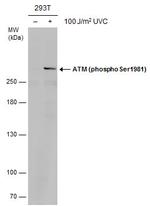 Phospho-ATM (Ser1981) Antibody in Western Blot (WB)