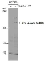 Phospho-ATM (Ser1981) Antibody in Western Blot (WB)