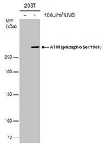 Phospho-ATM (Ser1981) Antibody in Western Blot (WB)