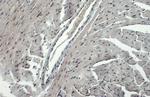 Phospho-ATR (Thr1989) Antibody in Immunohistochemistry (Paraffin) (IHC (P))