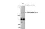 Phospho-ATR (Thr1989) Antibody in Western Blot (WB)