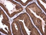 Axl Polyclonal Antibody