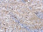 Axl Antibody in Immunohistochemistry (Paraffin) (IHC (P))