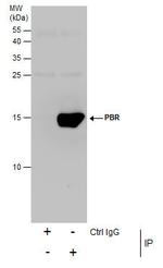 TSPO Antibody in Immunoprecipitation (IP)