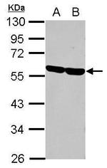 CD2 Antibody in Western Blot (WB)