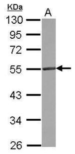 CD4 Antibody in Western Blot (WB)