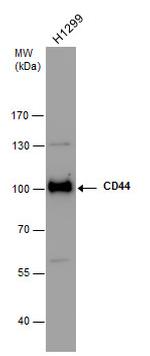 CD44 Antibody in Western Blot (WB)