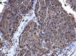 CDK1 Antibody in Immunohistochemistry (Paraffin) (IHC (P))
