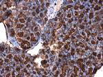Cdc25A Polyclonal Antibody