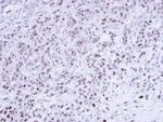 Cdc25C Antibody in Immunohistochemistry (Paraffin) (IHC (P))