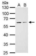 Cdc25C Antibody in Western Blot (WB)