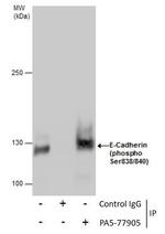 Phospho-E-cadherin (Ser838, Ser840) Antibody in Immunoprecipitation (IP)
