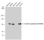 Phospho-E-cadherin (Ser838, Ser840) Antibody in Western Blot (WB)