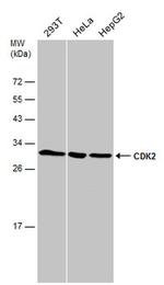 CDK2 Antibody in Western Blot (WB)