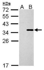 COL11A2 Polyclonal Antibody