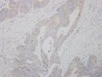 COMT Polyclonal Antibody