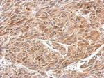 CRMP1 Polyclonal Antibody