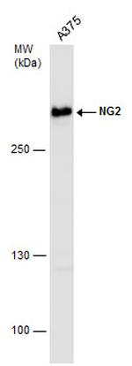 NG2 Antibody in Western Blot (WB)