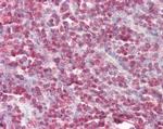 Cystatin B Antibody in Immunohistochemistry (Paraffin) (IHC (P))