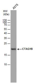 CTAG1B Polyclonal Antibody