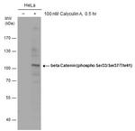 Phospho-beta Catenin (Ser33, Ser37, Thr41) Antibody in Western Blot (WB)