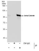 beta Catenin Antibody in Immunoprecipitation (IP)