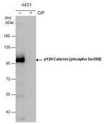 Phospho-delta Catenin (Ser268) Polyclonal Antibody