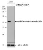 Phospho-delta Catenin (Ser268) Antibody