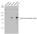 Phospho-delta Catenin (Ser268) Antibody in Western Blot (WB)