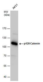 delta Catenin Polyclonal Antibody