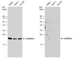 CYBA Antibody in Western Blot (WB)