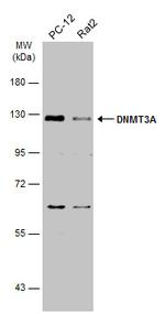 DNMT3A Antibody in Western Blot (WB)