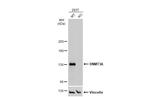 DNMT3A Antibody in Western Blot (WB)