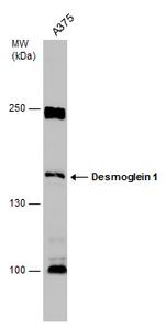 Desmoglein 1 Polyclonal Antibody
