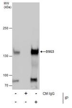 Desmoglein 3 Antibody in Immunoprecipitation (IP)