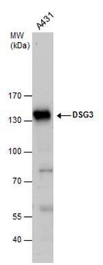 Desmoglein 3 Polyclonal Antibody